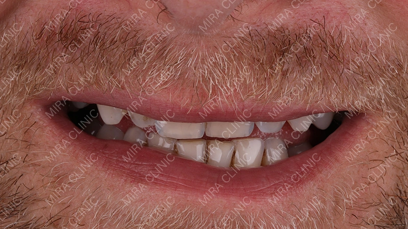 Problem Before Dental Treatment